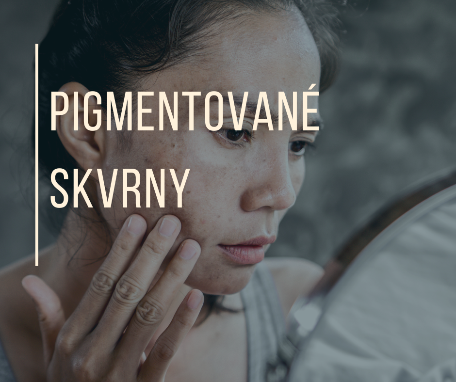 PIGMENTOVÉ SKVRNY