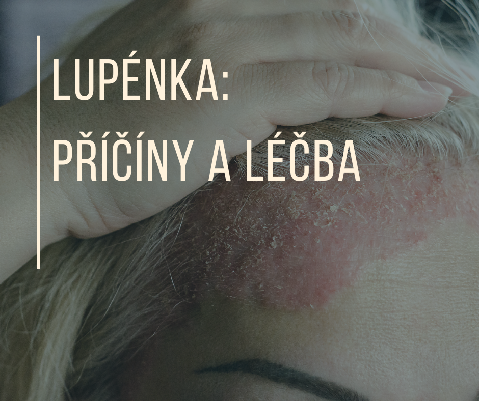 LUPÉNKA: Příčiny a léčba