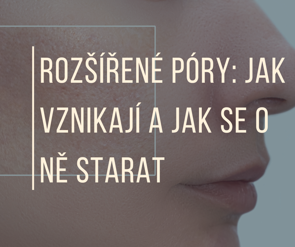 ROZŠÍŘENÉ PÓRY: JAK VZNIKAJÍ A JAK SE O NĚ STARAT