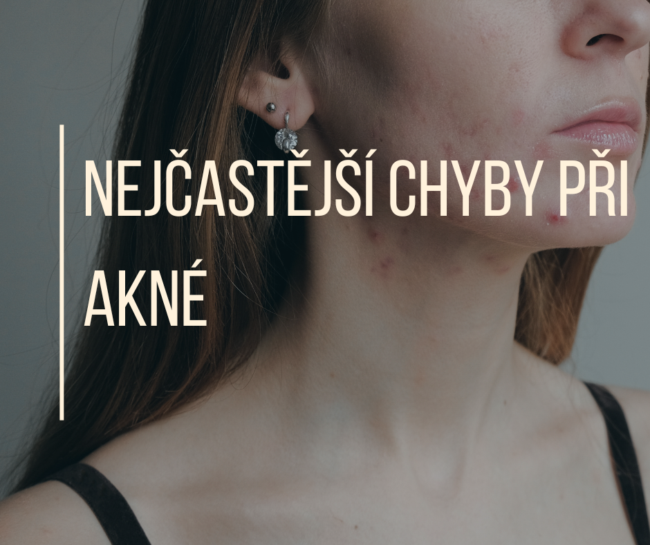 NEJČASTĚJŠÍ CHYBY PŘI AKNÉ