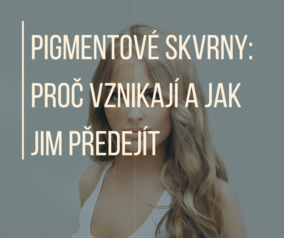 PIGMENTOVÉ SKVRNY: PROČ VZNIKAJÍ A JAK JIM PŘEDEJÍT