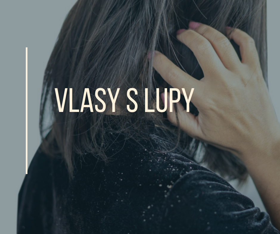 VLASY S LUPY