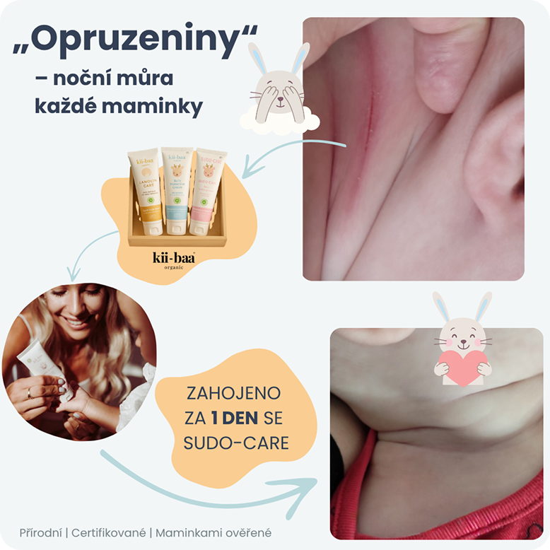 Opruzeniny banner