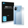 Xiaomi Mi 11 Lite (Hátlapi) típusú telefonhoz 6db-os Savvies SU75 kijelzőfólia