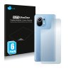 Xiaomi Mi 11 Lite 5G (Hátlapi) típusú telefonhoz 6db-os Savvies SU75 kijelzőfólia
