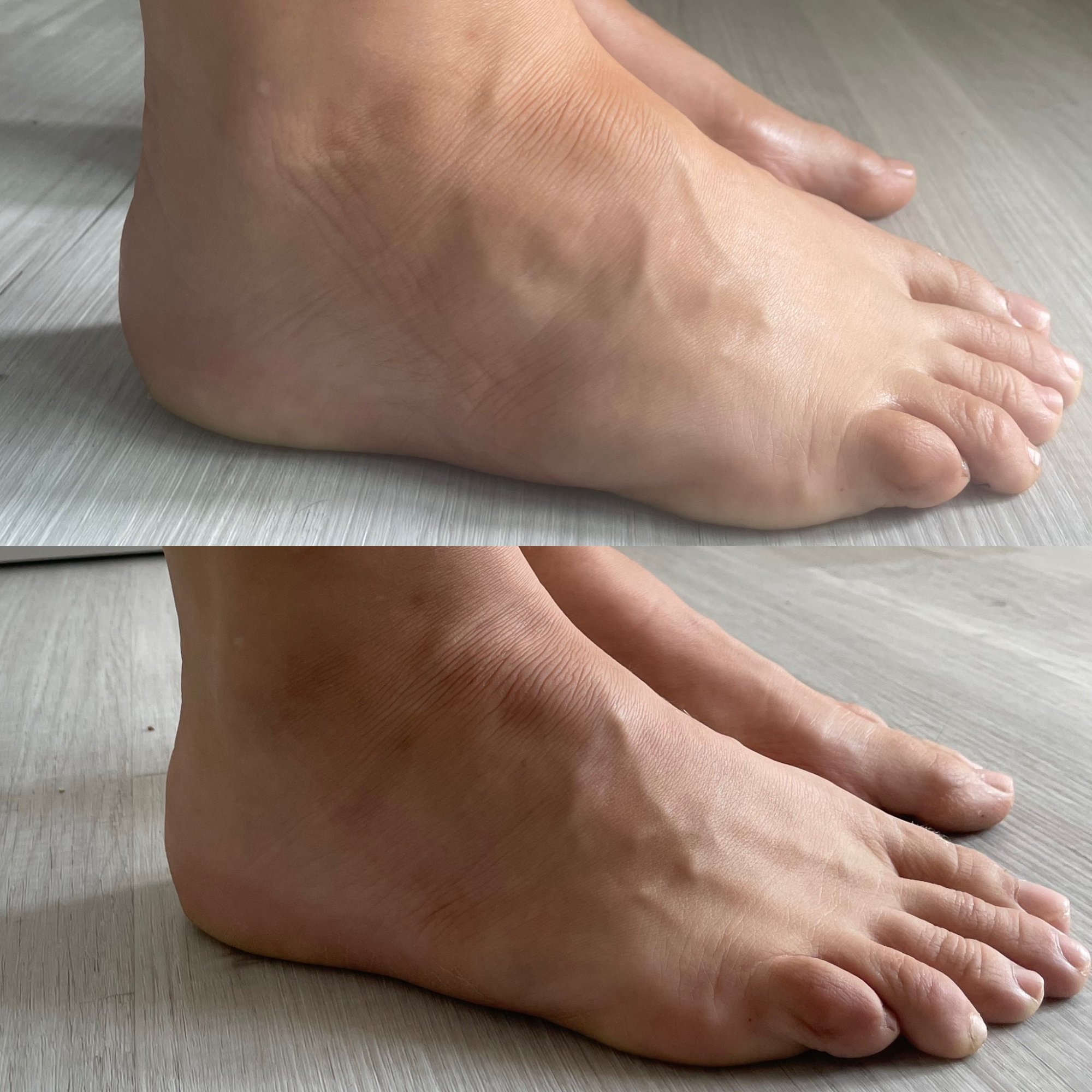 Proměna před a po masáži