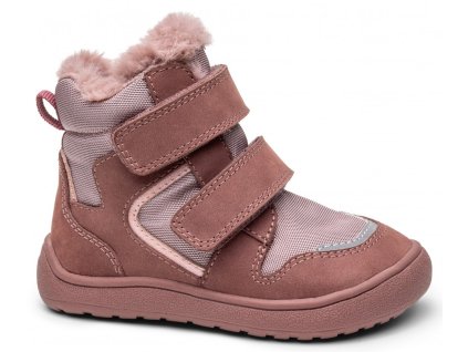 protetika daxi old pink