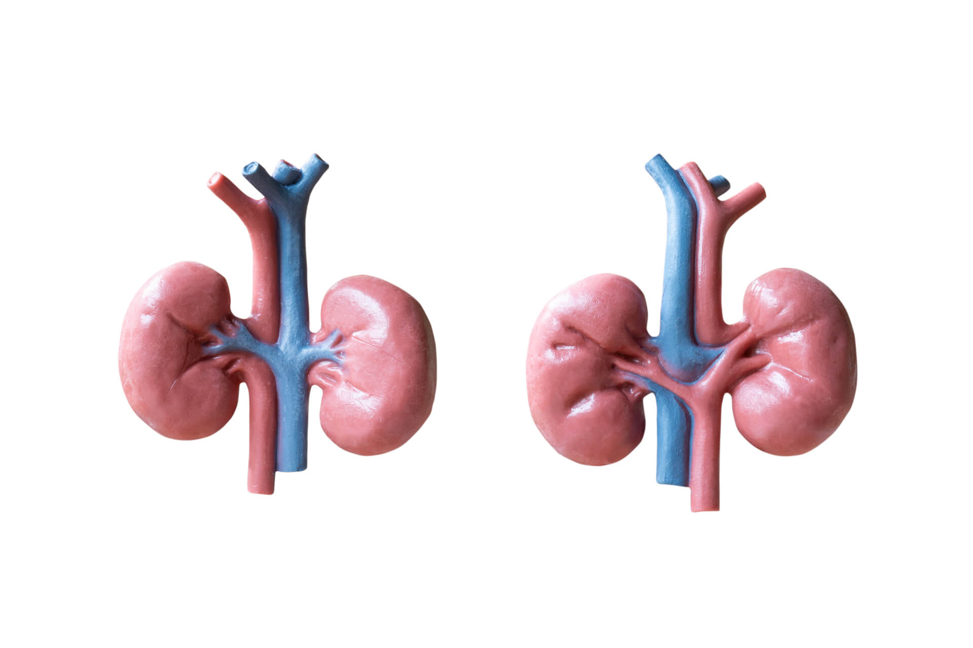 Starostlivosť o obličky: Ako udržať vaše obličky zdravé