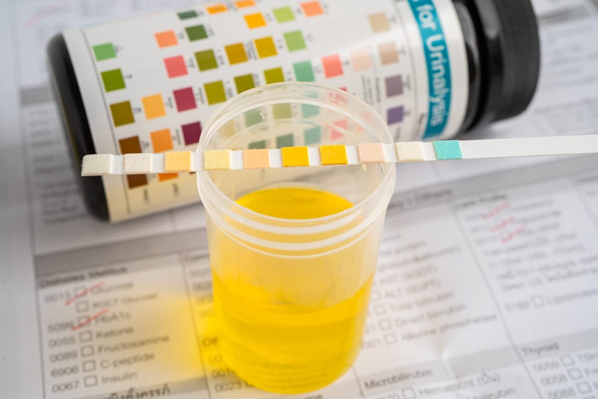 zapaly-mocovych-ciest