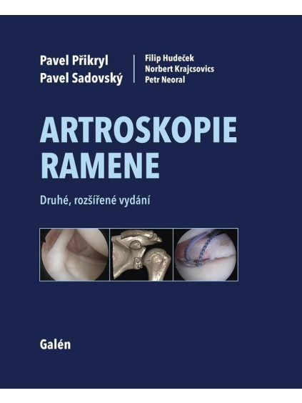 Artroskopie ramene