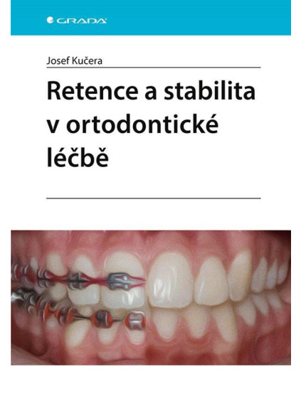 Retence a stabilita v ortodontické léčbě