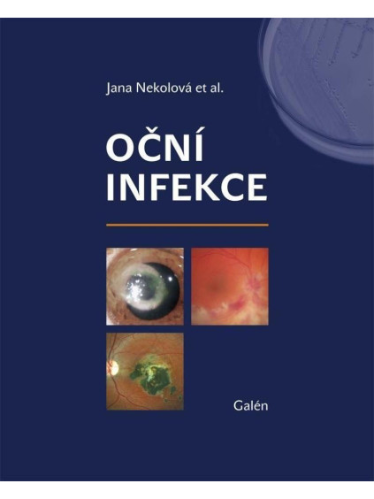 Oční infekce