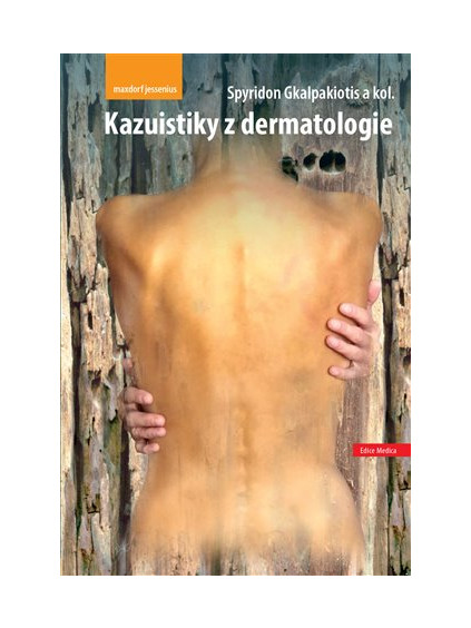 Kazuistiky z dermatologie
