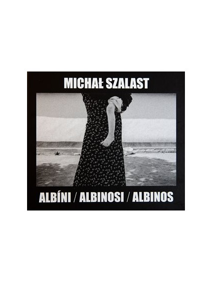 Albíni, Albinosi, Albinos