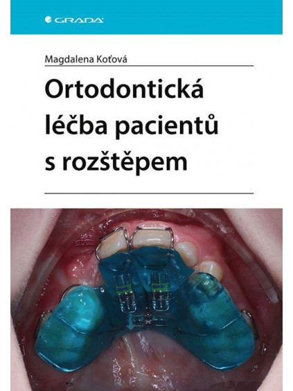 Ortodontická léčba pacientů s rozštěpem