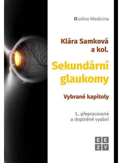 Sekundární glaukomy - Vybrané kapitoly