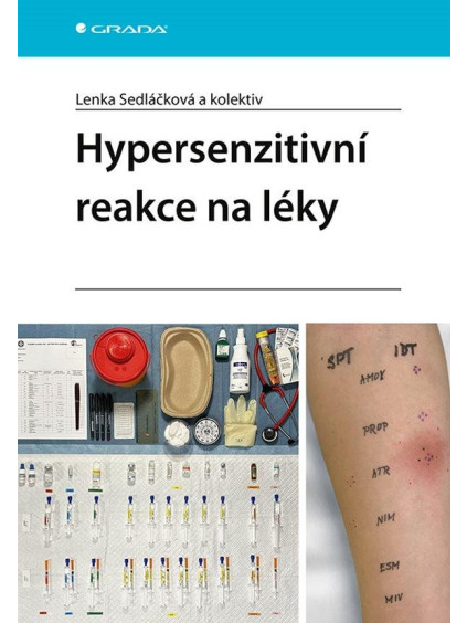 Hypersenzitivní reakce na léky