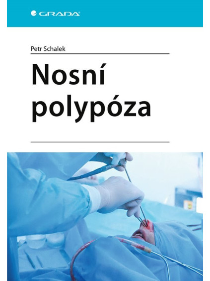 Nosní polypóza