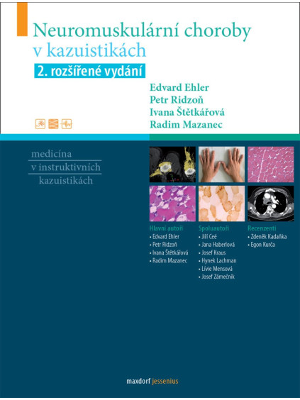 Neuromuskulární choroby v kazuistikách