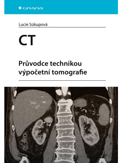 CT - Průvodce technikou výpočetní tomografie