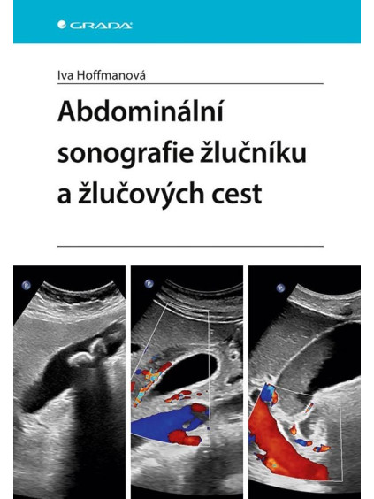 Abdominální sonografie žlučníku a žlučových cest