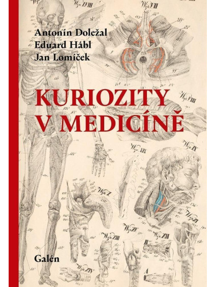 Kuriozity v medicíně