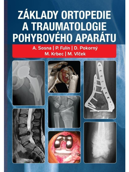 Základy ortopedie a traumatologie pohybového aparátu