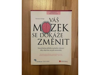 18168 vas mozek se dokaze zmenit