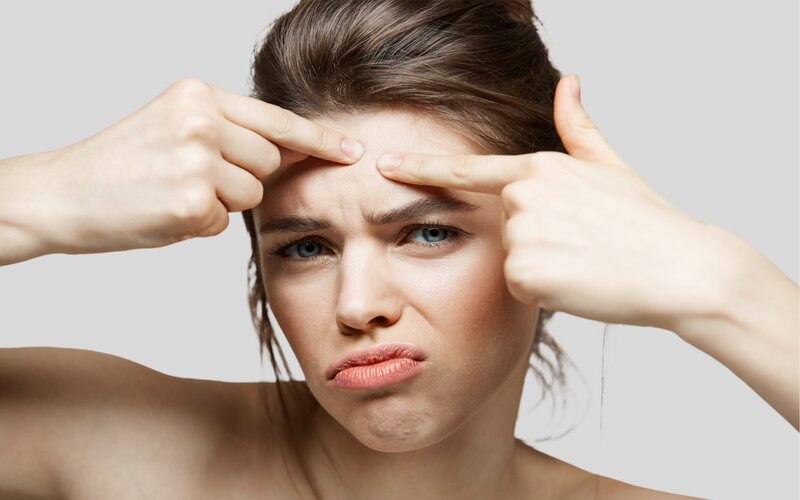 Kyselina salicylová –⁠ poklad pro mastnou pleť s akné