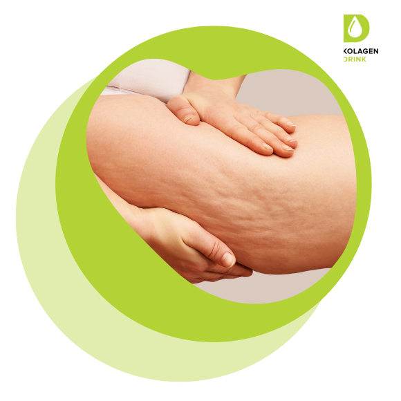 Kolagen proti celulitidě: Co ukazuje výzkum?