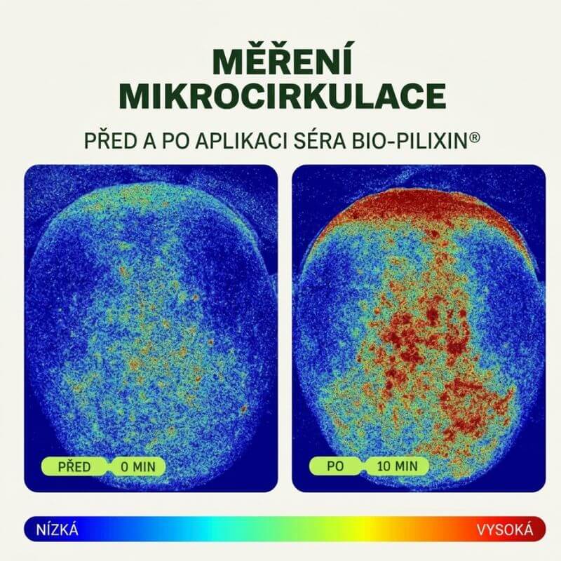 Měření mikrocirkulace pokožky hlavy před aplikací a 15 minut po aplikaci séra Bio-Pilixin
