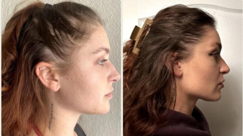Jessica před a po 150 dnech používání vlasové rutiny Scandinavian Biolabs