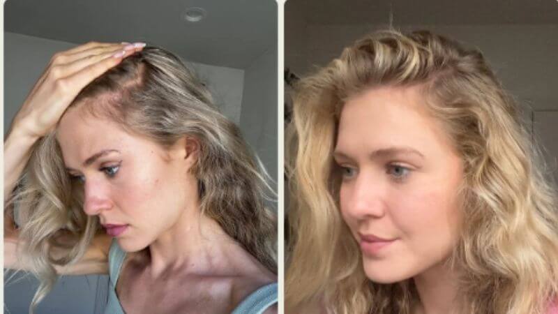 Sophie před a po používání produktů Scandinavian Biolabs
