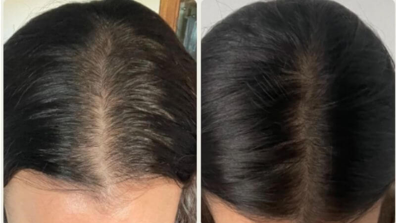 Rafaella Nieto – pěšinka vlasů před a po používání séra Bio-Pilixin