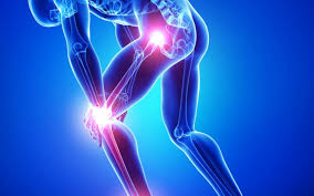 Kolagén pomáha zmierniť bolesti kĺbov