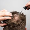 Bio-Pilixin® Activation Serum na spomalenie vypadávania a podporu rastu vlasov pre mužov 100 ml