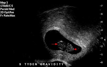 Olej CBD – wszystko działa, jak powinno