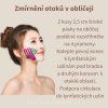 zmirneni otoku v obliceji 1