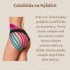 celulitida na hyždích
