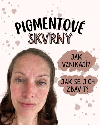 🌞 Pigmentové skvrny – zná je snad každá z nás. Vznikají hlavně vlivem slunce, hormonálních změn nebo stárnutí, kdy se v...