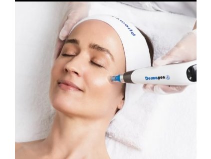 Ošetření Microneedlingem