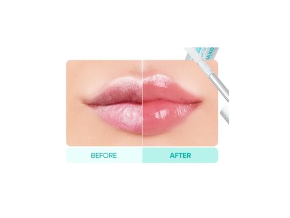 dr melaxin bp spicule plumping lip shot mild soft touch 4 ml (1)