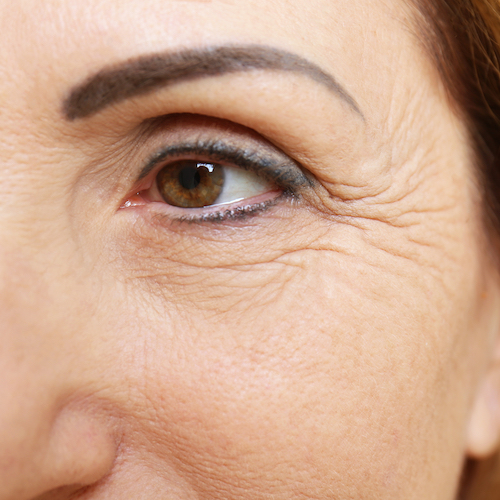 Vrásky okolo očí, rtů a dekoltu