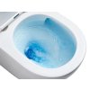 Závěsné WC Rimless Vortex se sedátkem s pomalým zavíráním, bílá