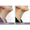 1564 1 rio beauty pristroj na zpevneni krku a brady fialovy neck4