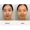 SkinGlow Mask Medisco