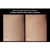 BEFORE AFTER Hydra perfecting body serum (1)