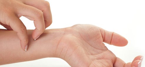 Arganový olej a jeho boj proti ekzému