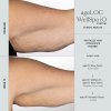 WellSpa iO before after 3min 3x arm 600x600 bc87582
