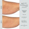 WellSpa iO before after 3min 3x arm 2 600x600 bc87582